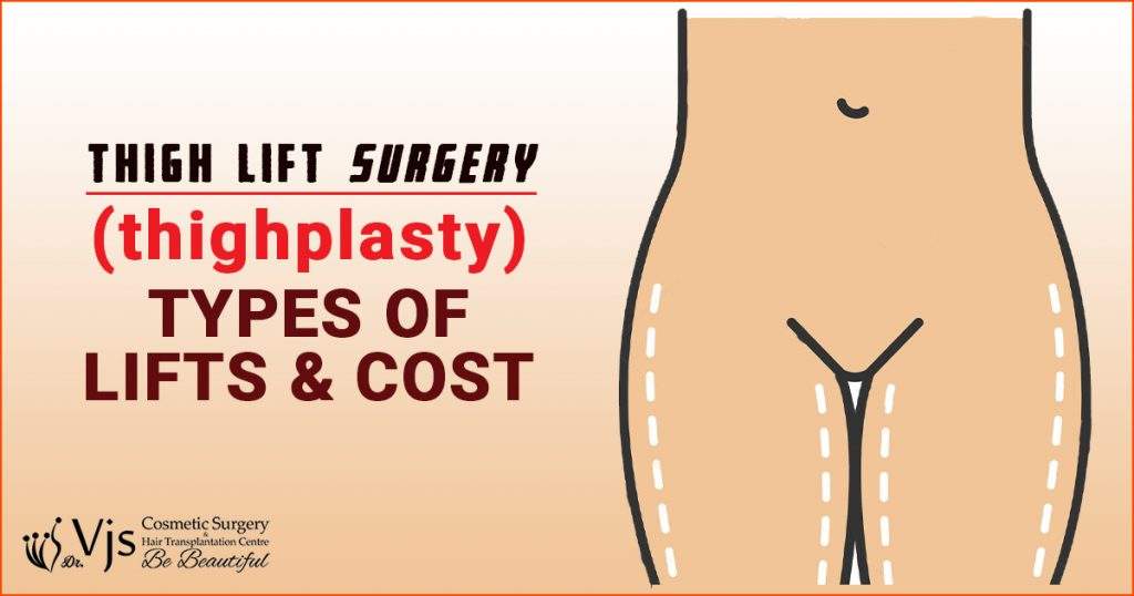 Thigh lift surgery (Thighplasty) – Procedure, Types of Thigh lifts & cost