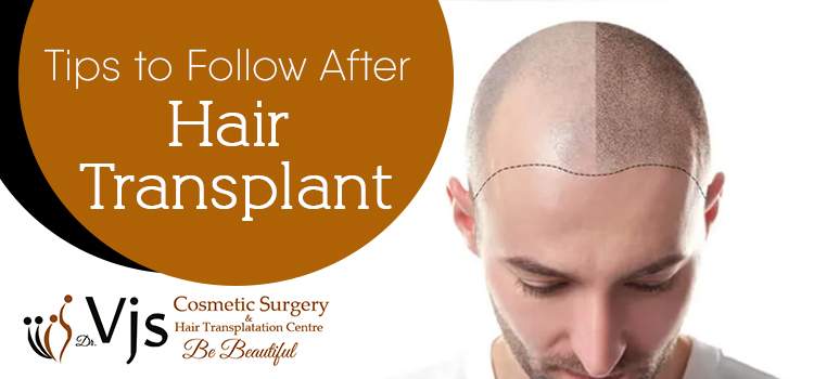 Avoid these things after a hair transplant