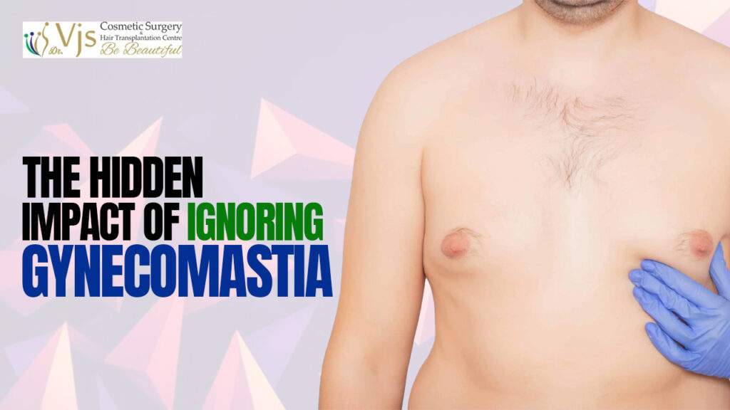 Debunking the Myths Associated with Gynecomastia