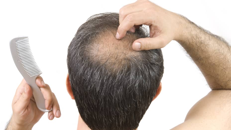 Treatment plans for hair problems.