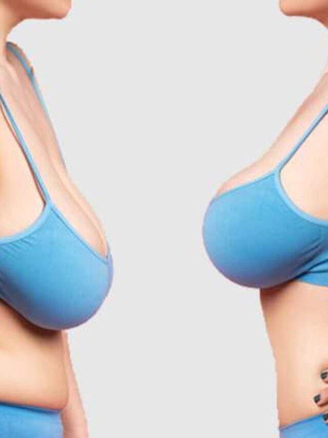 Critical Benefits of breast Reduction surgery