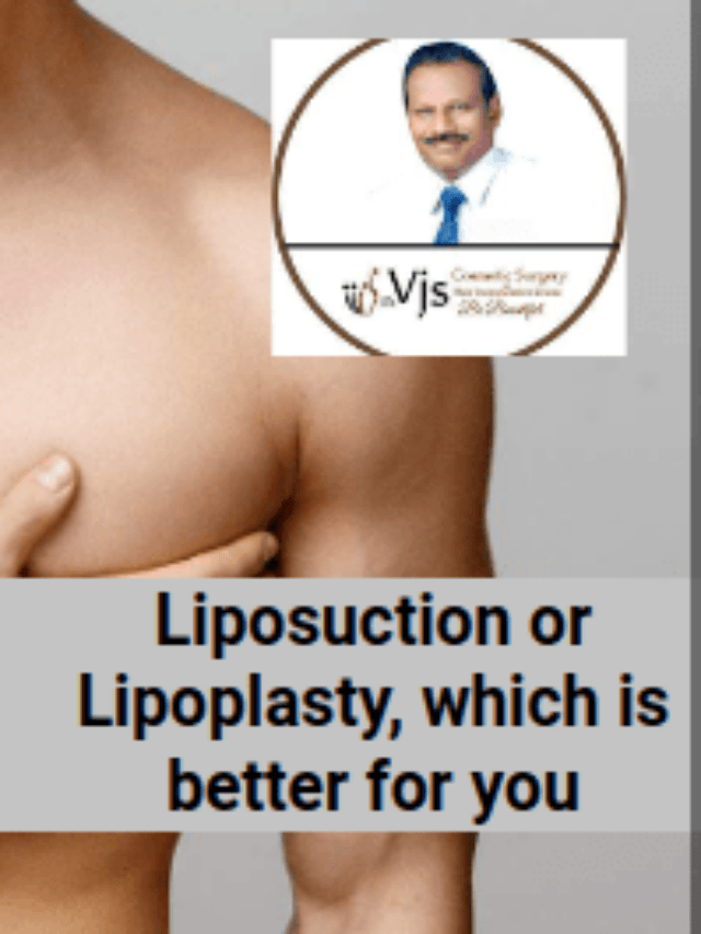 Liposuction or Lipoplasty, which is better for you