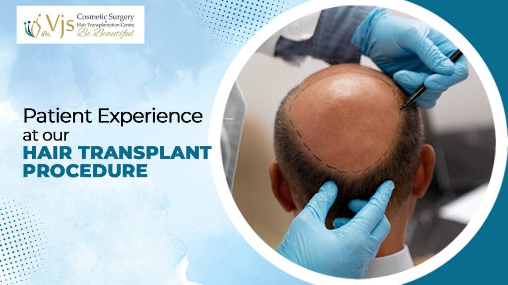 Patient Experience at our hair transplant procedure