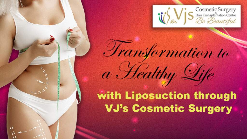 Transformation to a Healthy Life with Liposuction through VJ’s Cosmetic Surgery