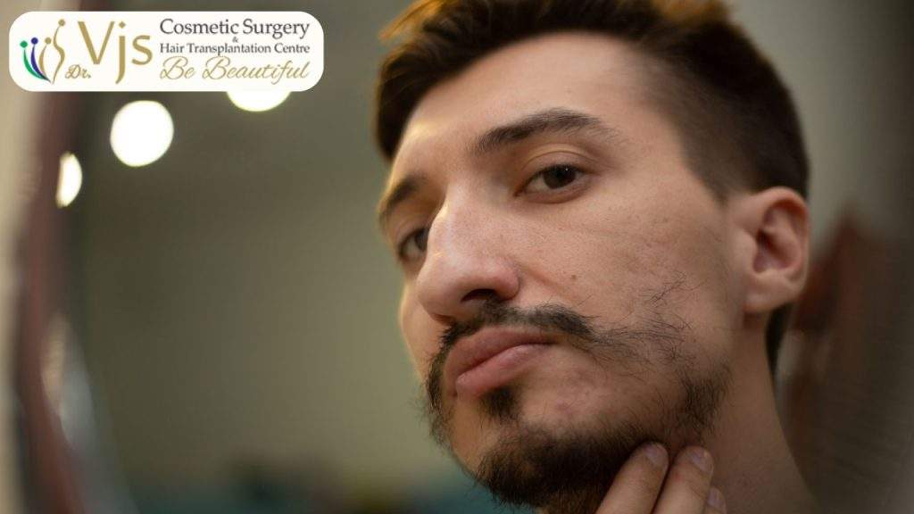 Male with beard and mustache in a cosmetic surgery consultation at VJ Clinics.