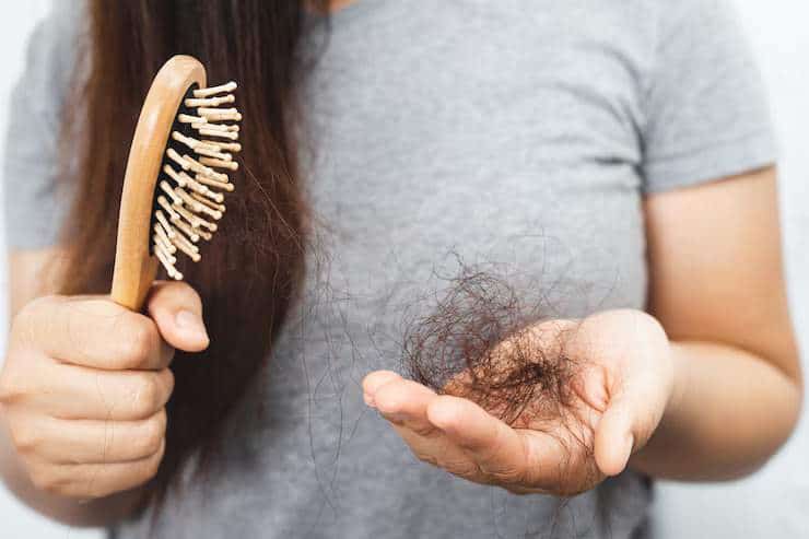 Thick hairbrush and loose hair in hand, representing hair loss treatment at VJ Clinics.