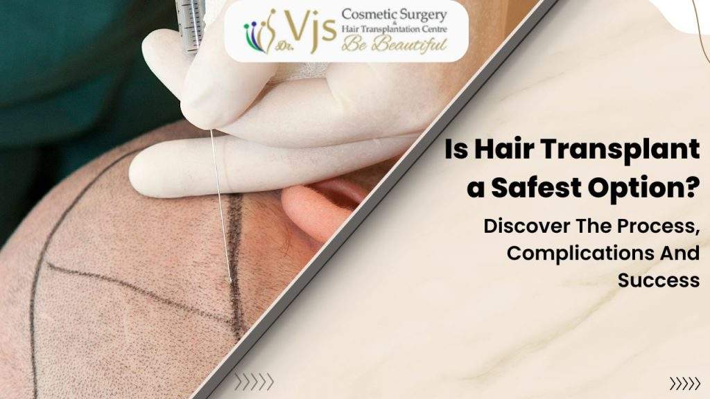 Is Hair Transplant a Safest Option? Discover The Process, Complications And Success.