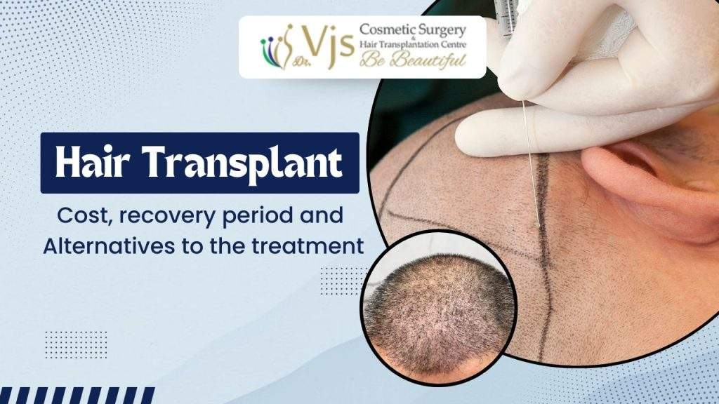 Hair Transplant Procedure Cost, recovery and alternatives