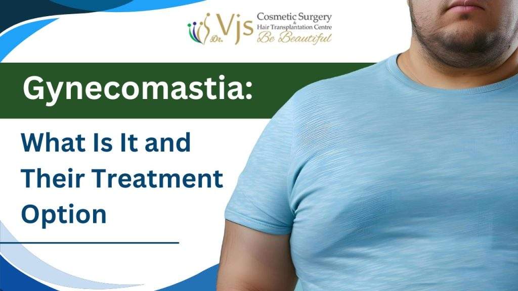 Gynecomastia Causes, Symptoms, and Treatment Options