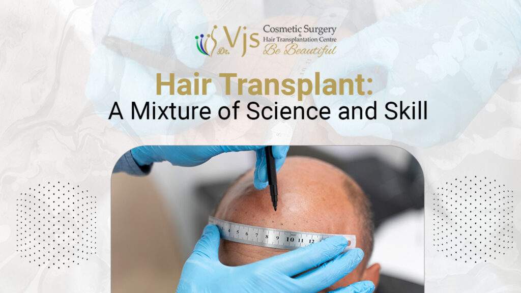 Hair Transplant Where Science Meets Skill