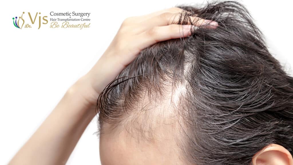 How Smoking Damages Hair Health: Effects on Scalp & Follicles