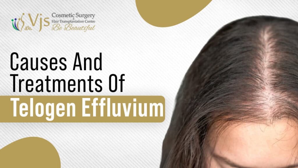 What Causes Telogen Effluvium and How to Treat It