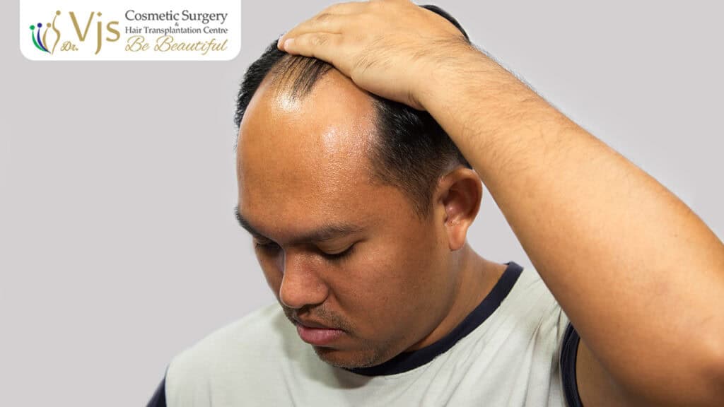 5 Effective Treatment Options for Hair Loss Tailored Solutions for Different Hair Conditions