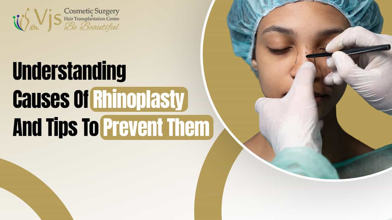 Why Rhinoplasty is Needed: Causes and Preventive Tips