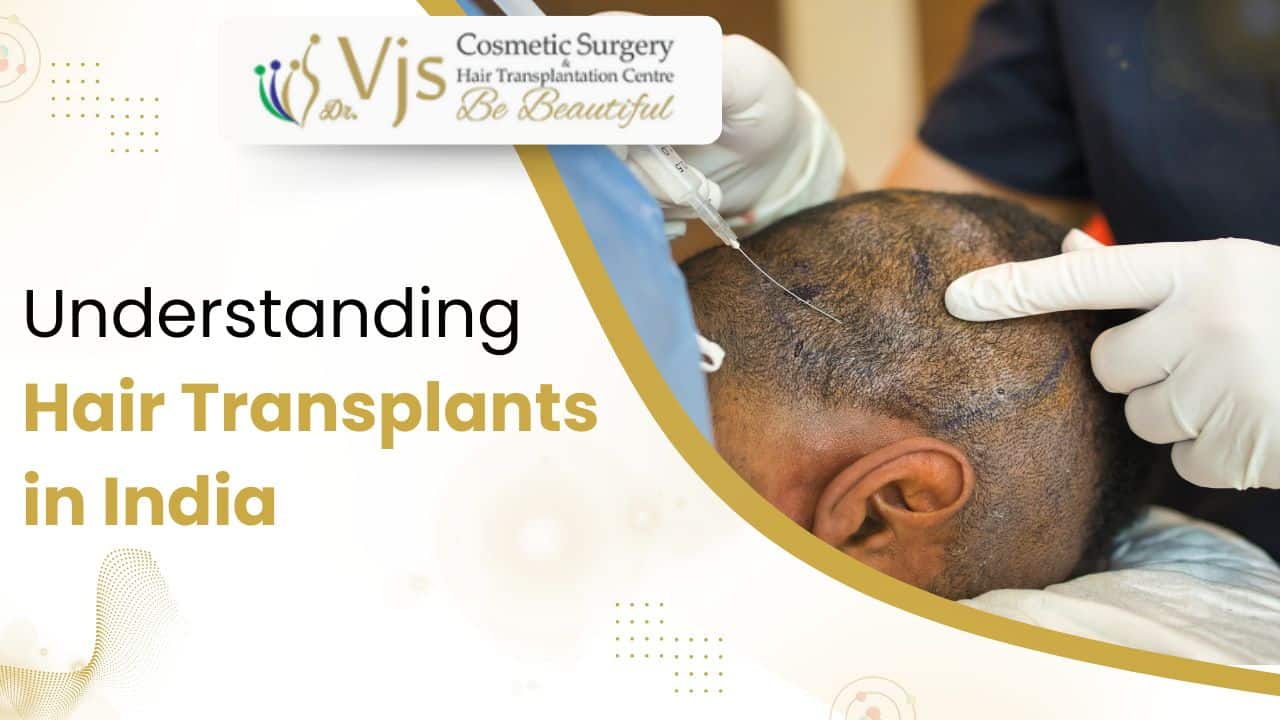 Enhanced hair transplant procedure at VJ Clinics in India.