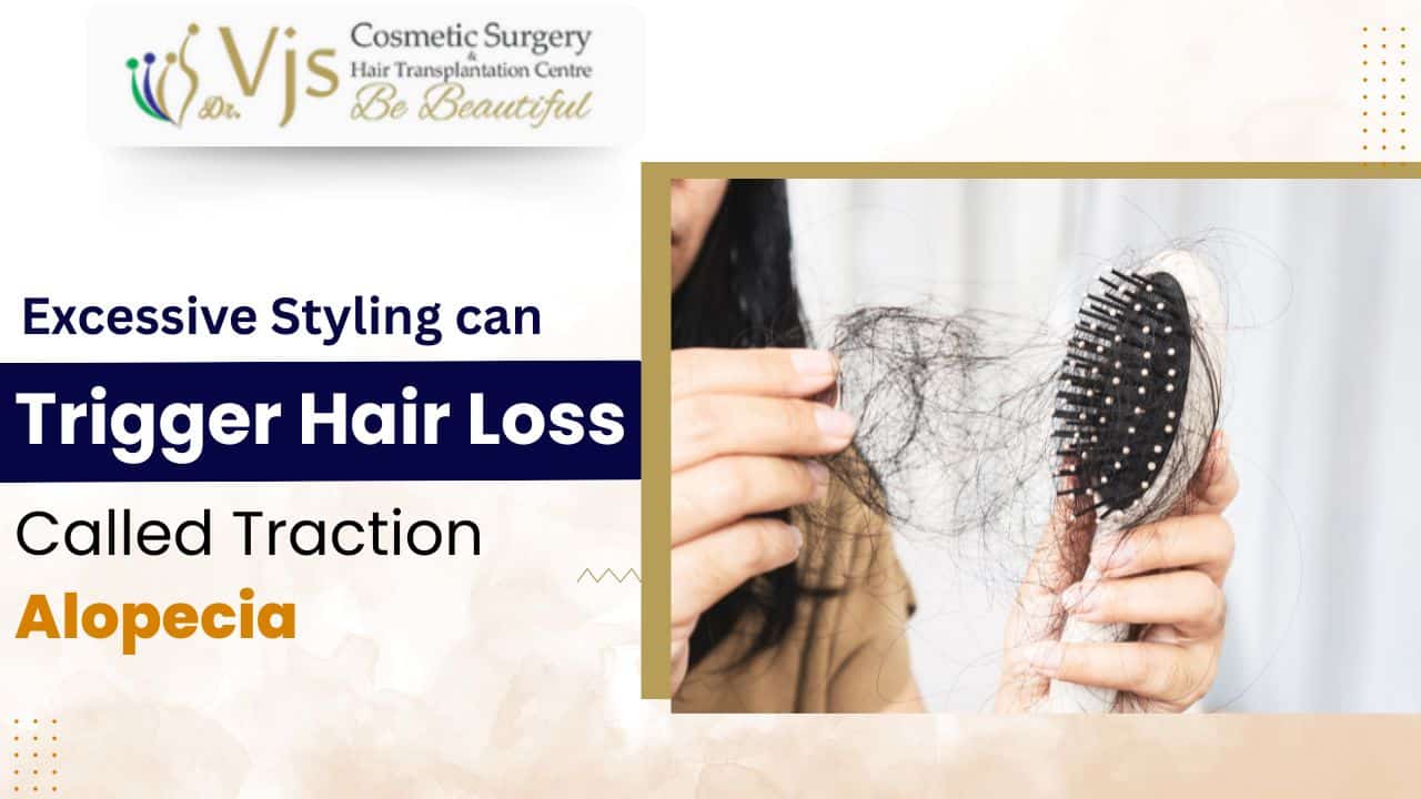 Thinning hair on a hairbrush indicating hair loss caused by excessive styling and traction alopecia.
