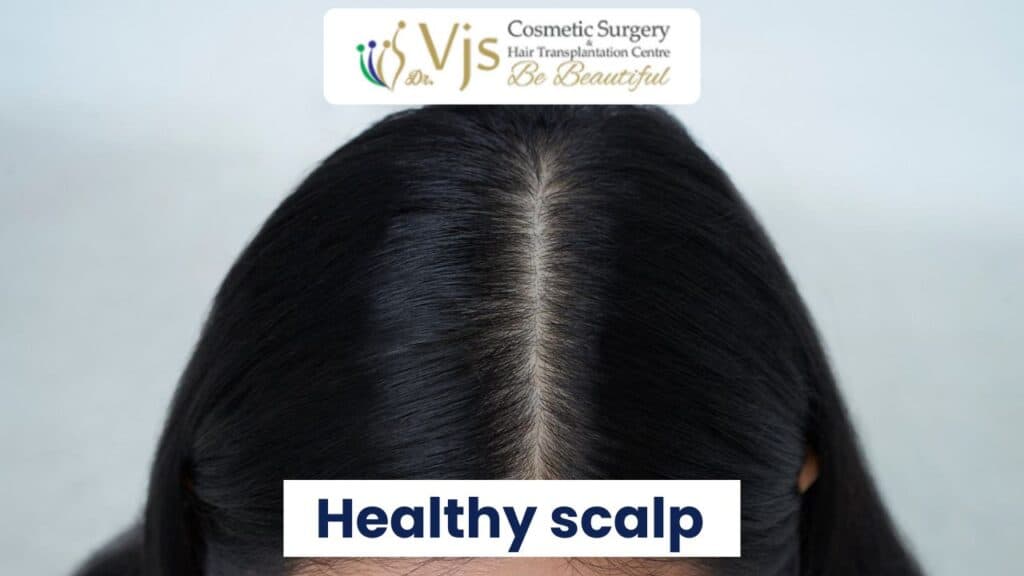 Healthy scalp with thick, shiny hair and visible hair growth.