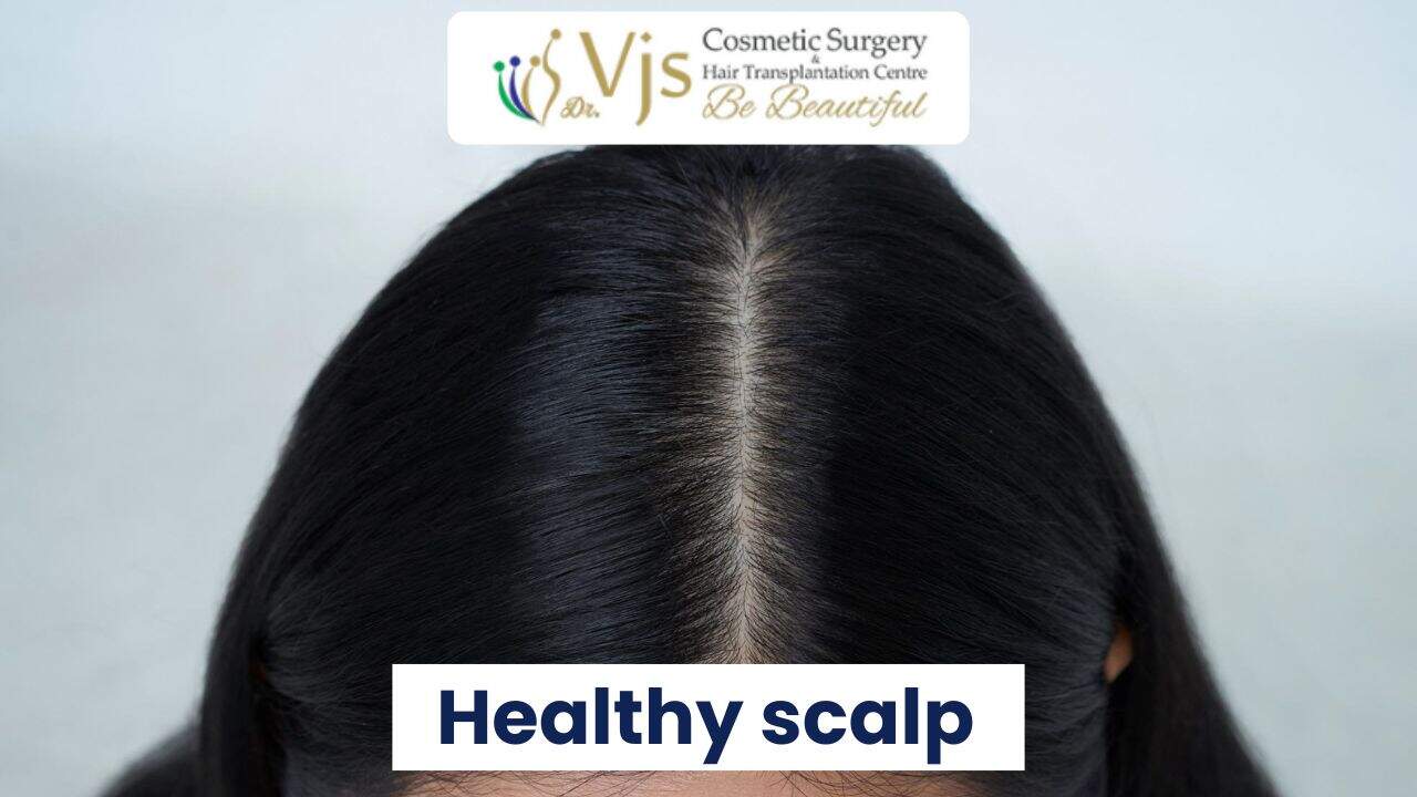 Healthy scalp with thick, shiny hair and visible hair growth.