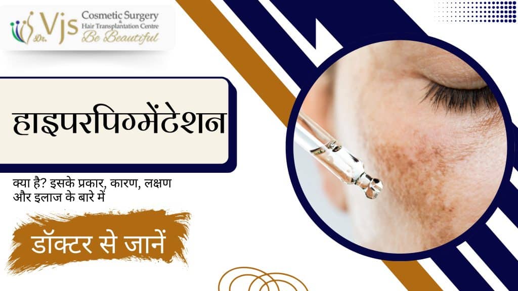 what-is-hyperpigmentation-learn-from-a-doctor-about-its-types-causes-symptoms-and-treatment