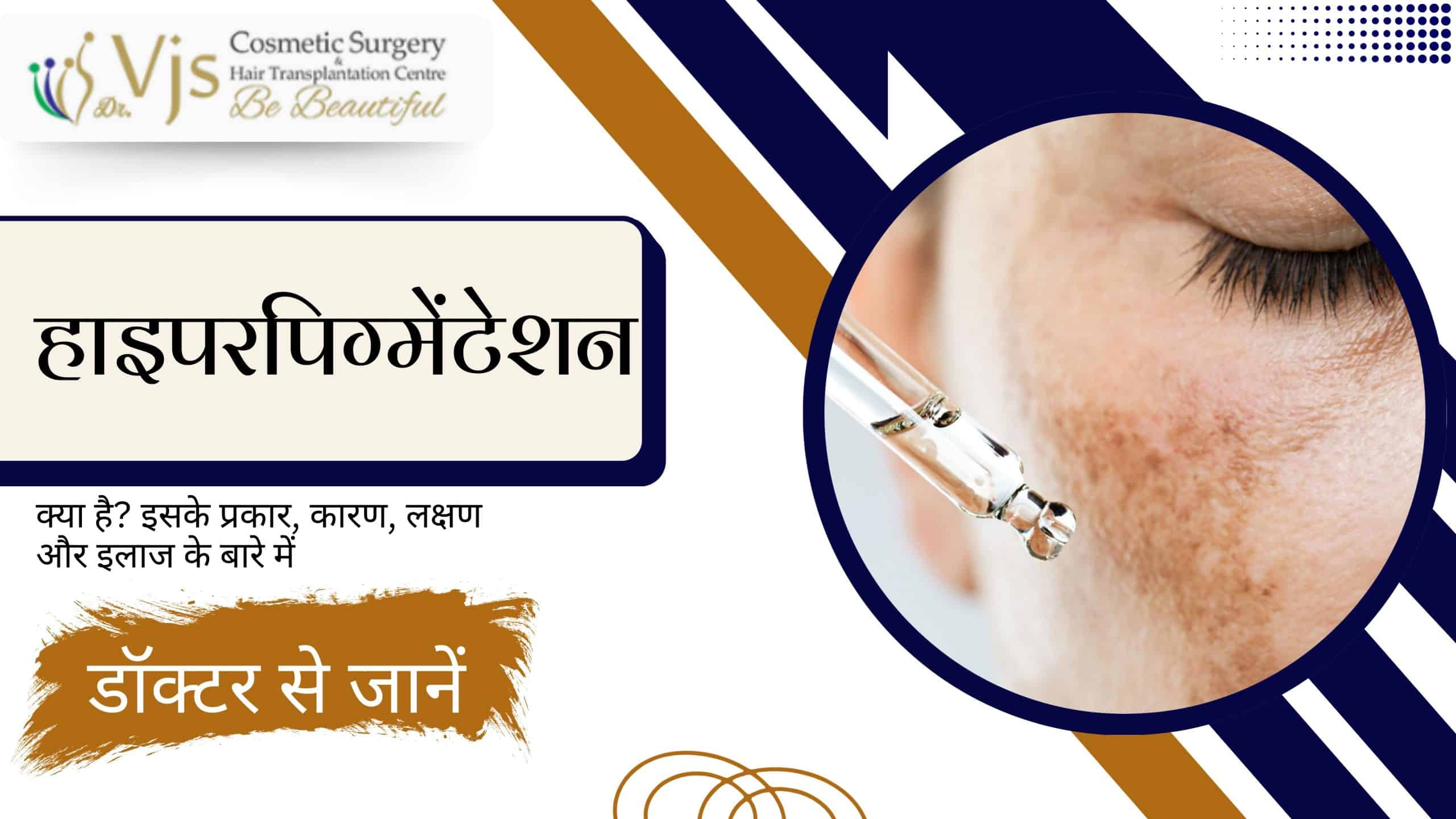 what-is-hyperpigmentation-learn-from-a-doctor-about-its-types-causes-symptoms-and-treatment