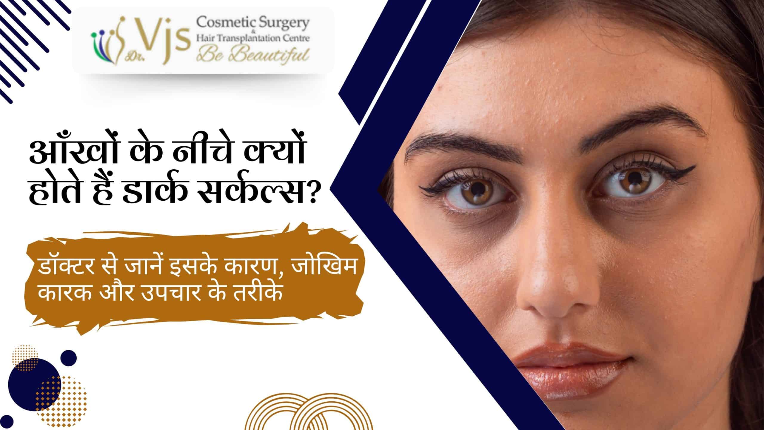 why-do-dark-circles-appear-under-the-eyes-learn-the-causes-risk-factors-and-treatment-methods-from-a-doctor