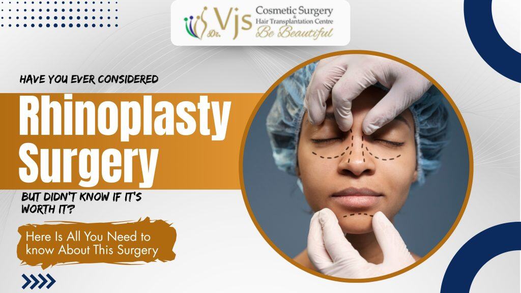 Have You Ever Considered Rhinoplasty Surgery But Didn’t Know If It’s Worth It? Here Is All You Need to know About This Surgery