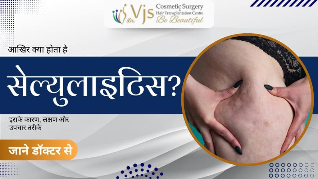 what-exactly-is-cellulitis-learn-about-its-causes-symptoms-and-treatment-methods-from-a-doctor