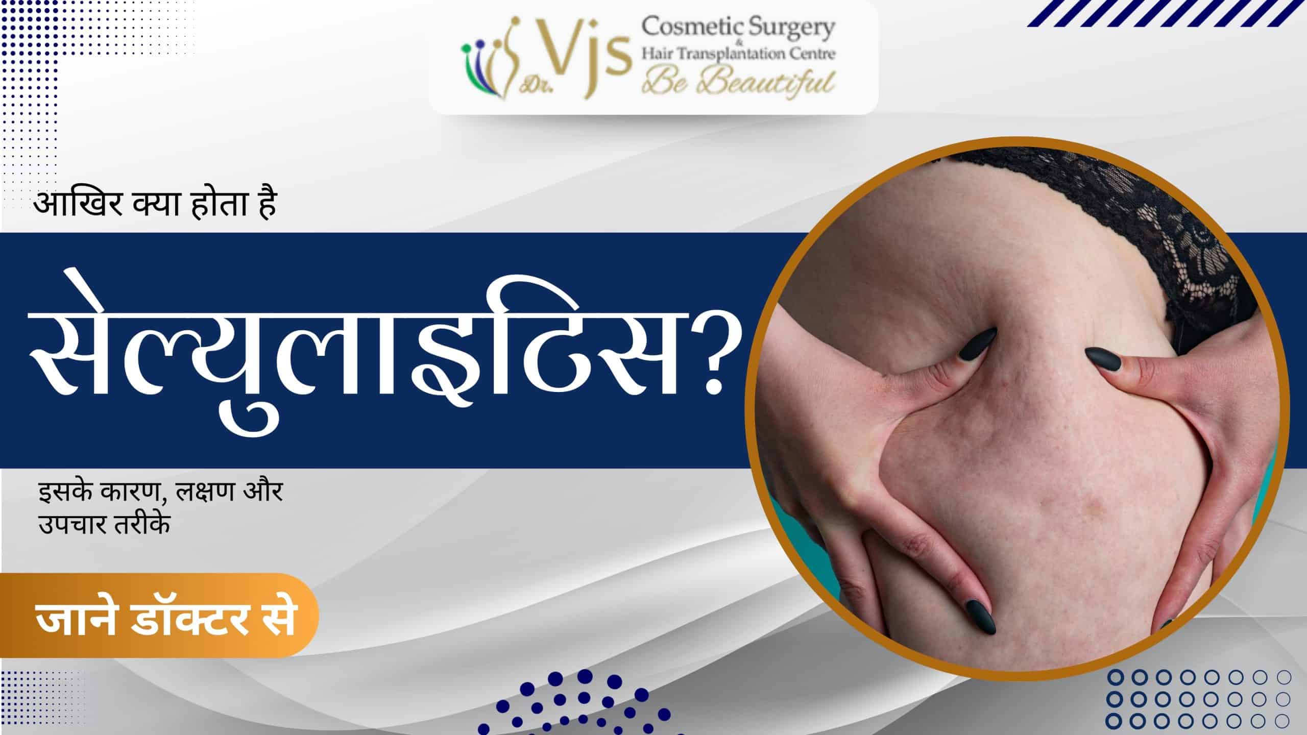 what-exactly-is-cellulitis-learn-about-its-causes-symptoms-and-treatment-methods-from-a-doctor