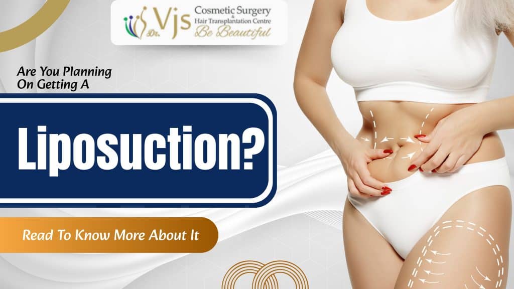 Are You Planning On Getting A Liposuction? Read To Know More About It