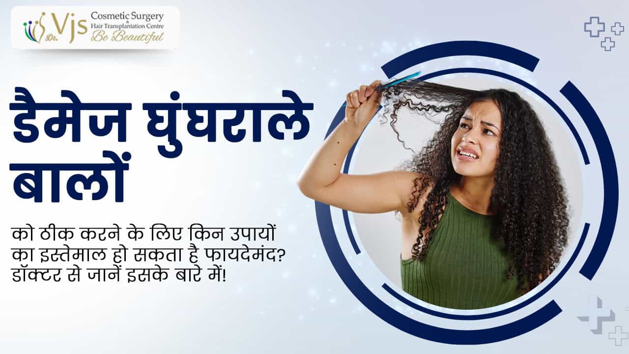 Woman with curly hair holding a hair strand, promoting hair transplant consultation at VJ Clinics.