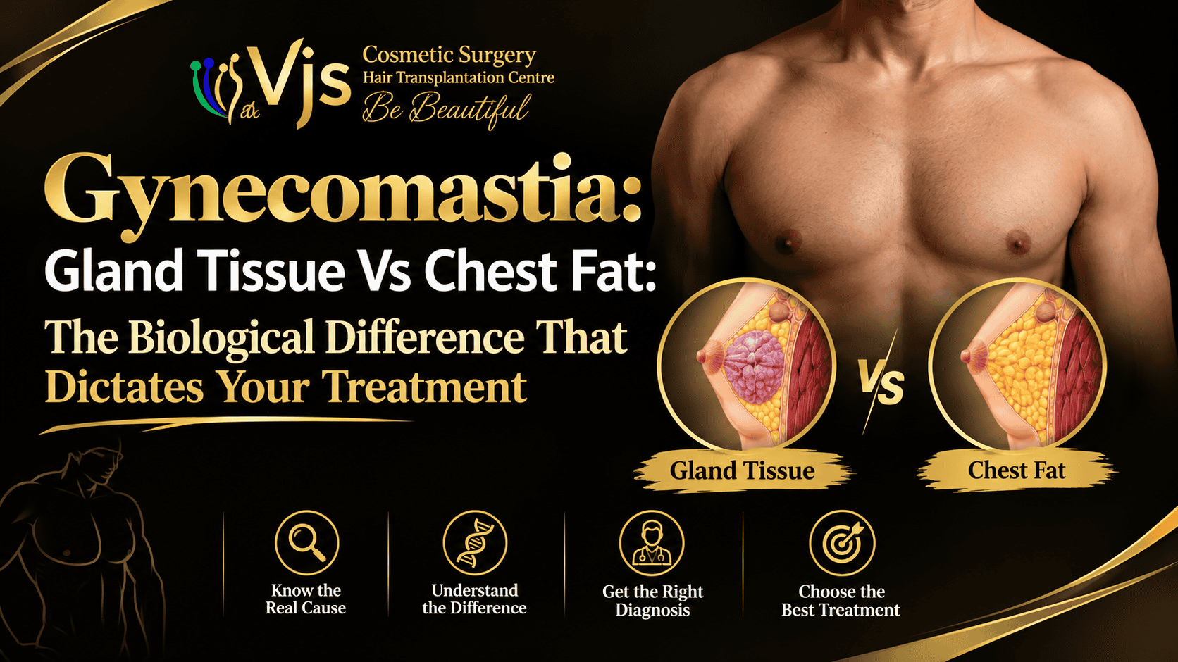 Comparison of gland tissue and chest fat in gynecomastia treatment.